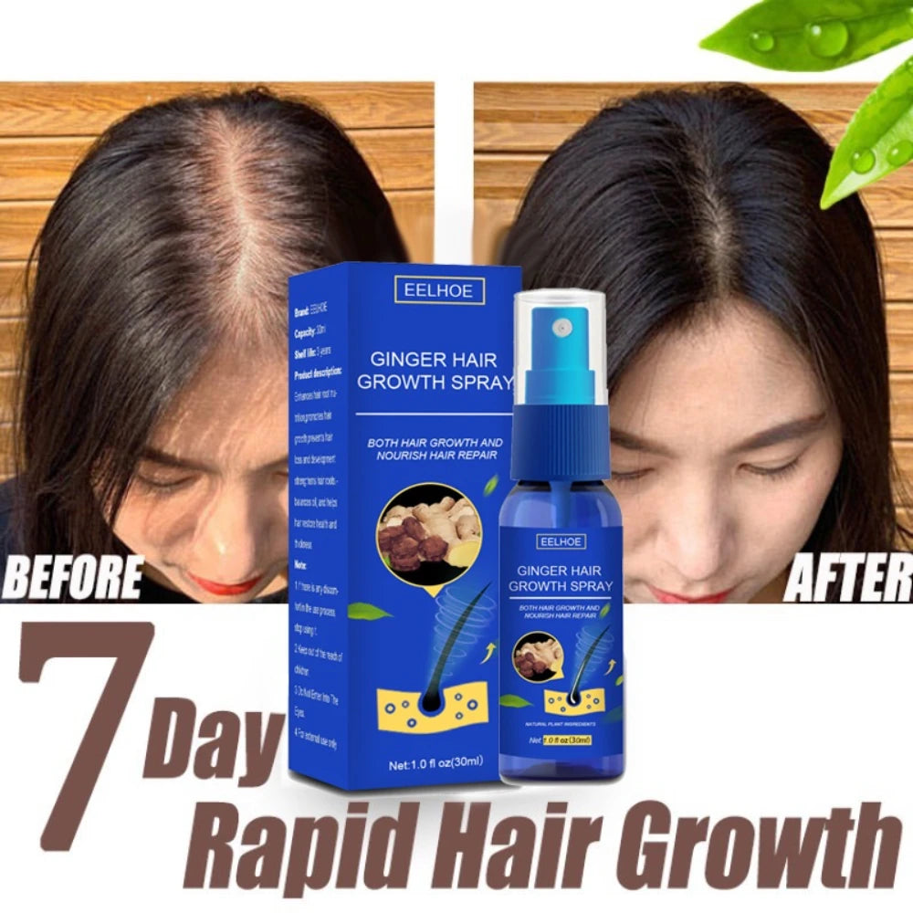 Ginger Hair Growth spray Anti Hair Fall Hair Loss Treatment Hair Growth Essence Oil for Men Women hair treatment