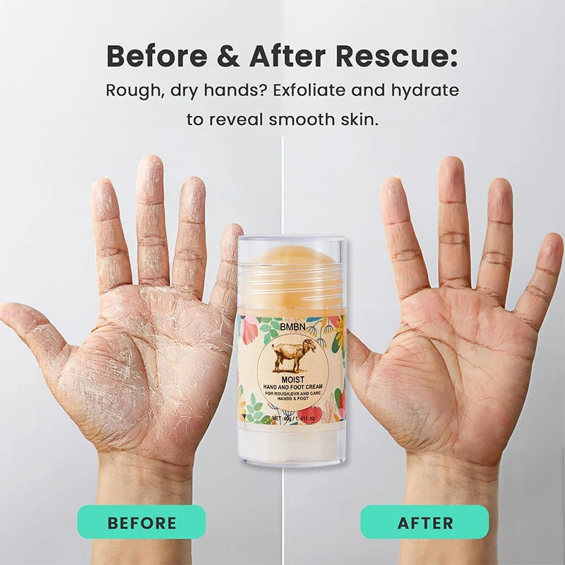 Lanolin‑enriched hand and foot cream deeply repairs cracked, dry skin. Protective formula moisturizes, softens, and restores resilience, leaving hands and feet smooth, nourished, and comfortable daily.