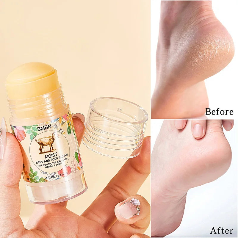Lanolin‑enriched hand and foot cream deeply repairs cracked, dry skin. Protective formula moisturizes, softens, and restores resilience, leaving hands and feet smooth, nourished, and comfortable daily.