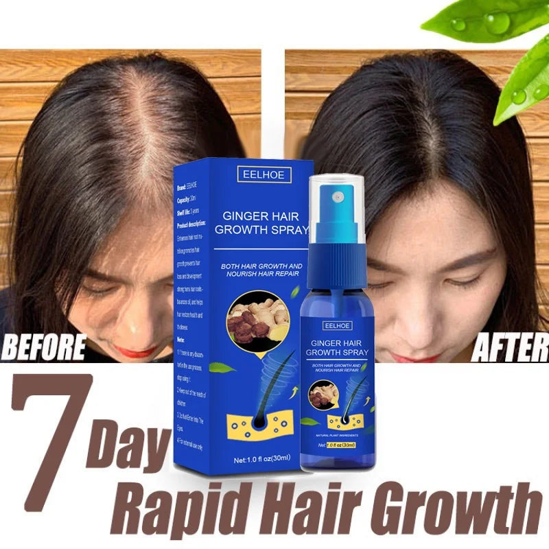 Ginger Hair Growth spray Anti Hair Fall Hair Loss Treatment Hair Growth Essence Oil for Men Women hair treatment