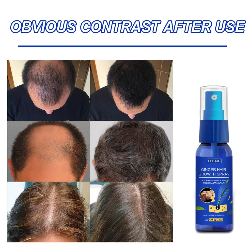 Ginger Hair Growth spray Anti Hair Fall Hair Loss Treatment Hair Growth Essence Oil for Men Women hair treatment